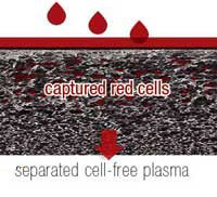 Highly Asymmetric Hydrophilic PES for Blood Separation